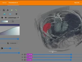Tensor's 220% Price Jump: What's Behind the Pump and the AI Connection